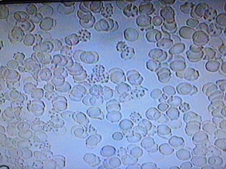 Live Blood Cell pic